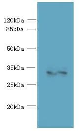 Polyclonal Rabbit anti-Human SPRYD5 Antibody (IHC, WB)