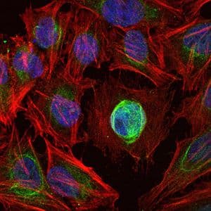 Monoclonal Mouse anti-Human MMP1 Antibody (clone 6A5, IHC, IF, WB)