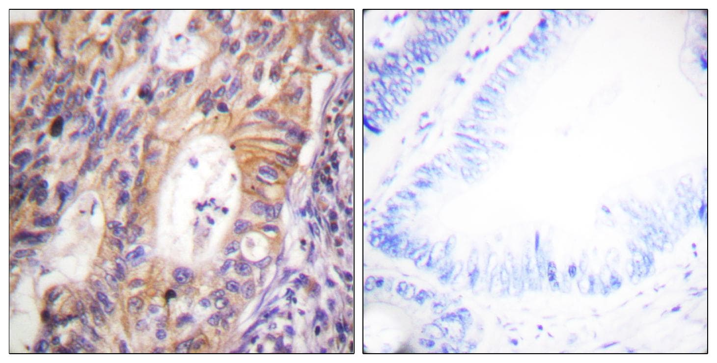 Polyclonal Rabbit anti-Human c-Met Antibody (phospho-Tyr1003, IHC, IF, WB)