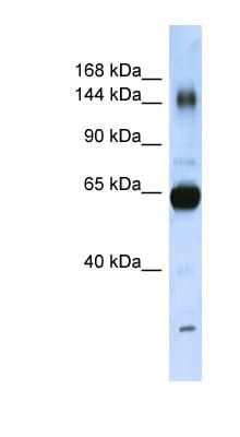 COL11A2 / Collagen XI Antibody (aa323-372)