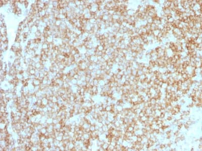 CD45 / LCA Antibody (clone PTPRC/1783R + PTPRC/1975R, Azide-free, Carrier-free)