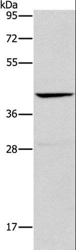 IHC-plus™ ORM2 / Orosomucoid 2 Antibody