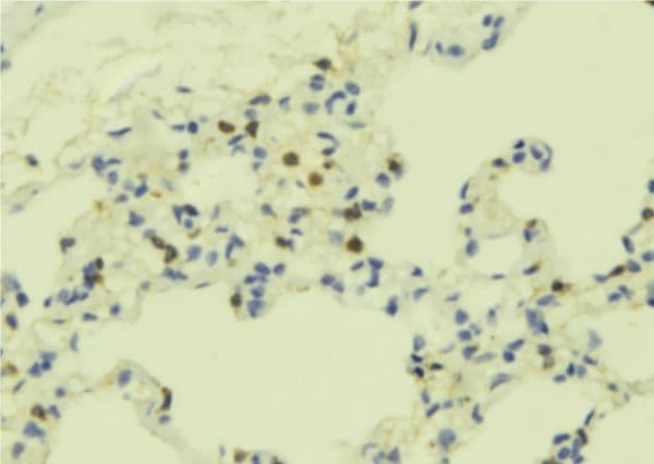 ADCY3 / Adenylate Cyclase 3 Antibody
