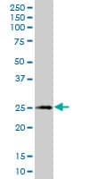 IHC-plus™ Monoclonal Mouse anti-Human XBP1 Antibody (clone 2D9, IHC, WB)