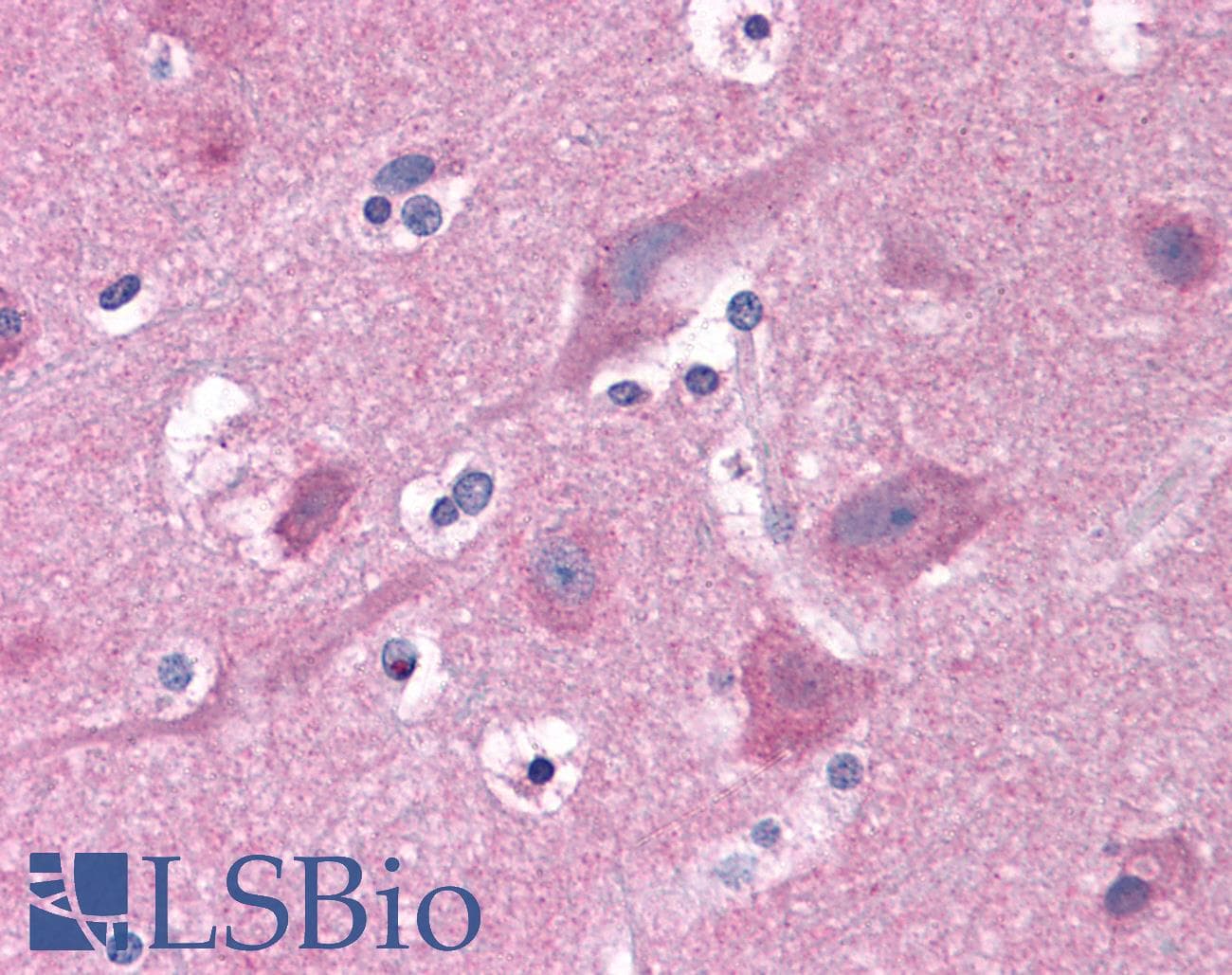 IHC-plus™ Polyclonal Rabbit anti-Human PAK1 Antibody (IHC, WB)