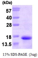 Human TAC3 / Tachykinin Protein (Recombinant His)