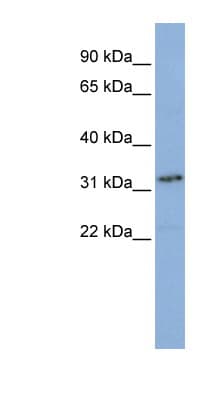 Polyclonal Rabbit anti-Human SNAP45 / SNAPC2 Antibody (aa36-85, WB)