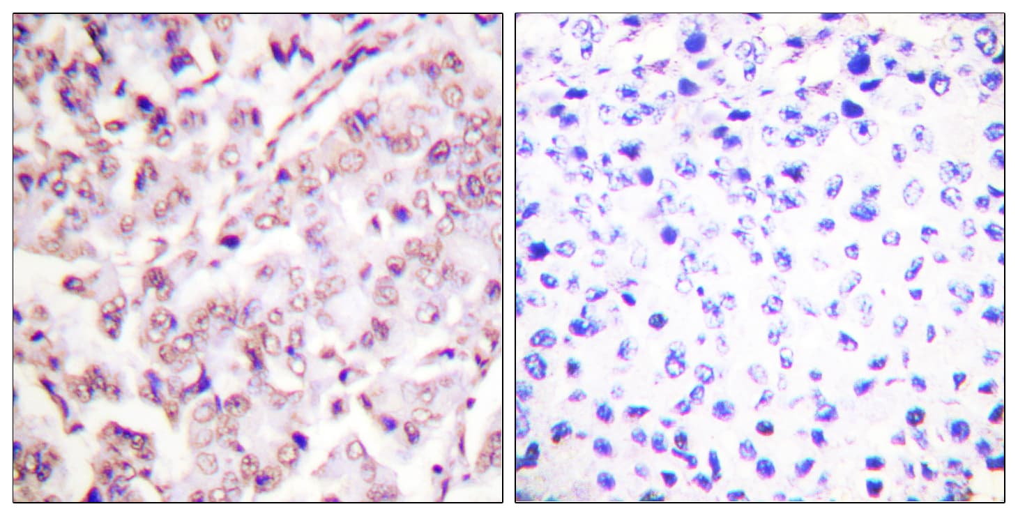 ETS1 / ETS-1 Antibody (phospho-Thr38)