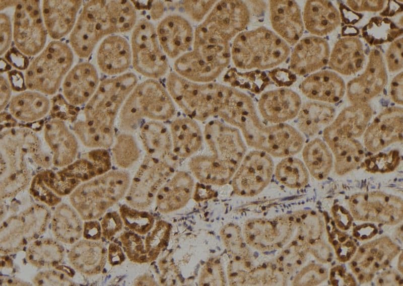 Polyclonal Rabbit anti-Human DIRC1 Antibody (IHC, WB)