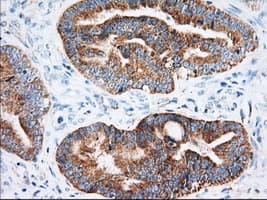 IGF2BP2 Antibody (clone OTI3F9)
