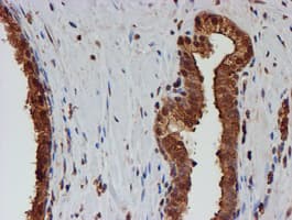 PSMB9 Antibody (clone OTI3F3)