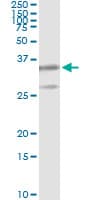 PSMB8 / LMP7 Antibody (clone 1B3)