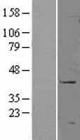 CD177 Protein (Over-Expression Lysate Myc-DDK (Flag))