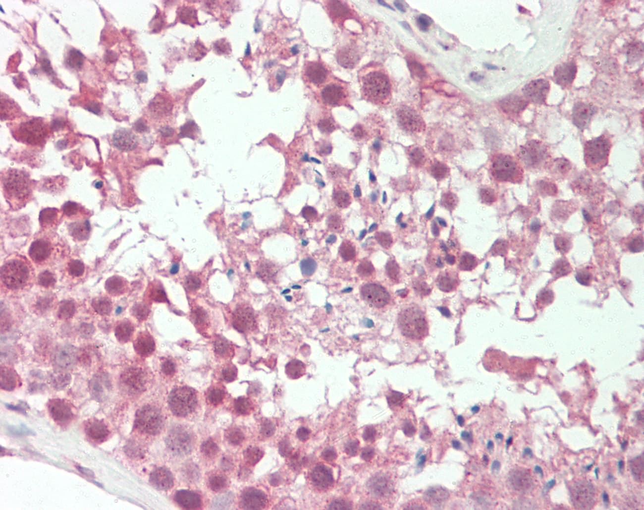CBFA2T2 / MTGR1 Antibody (C-Terminus)