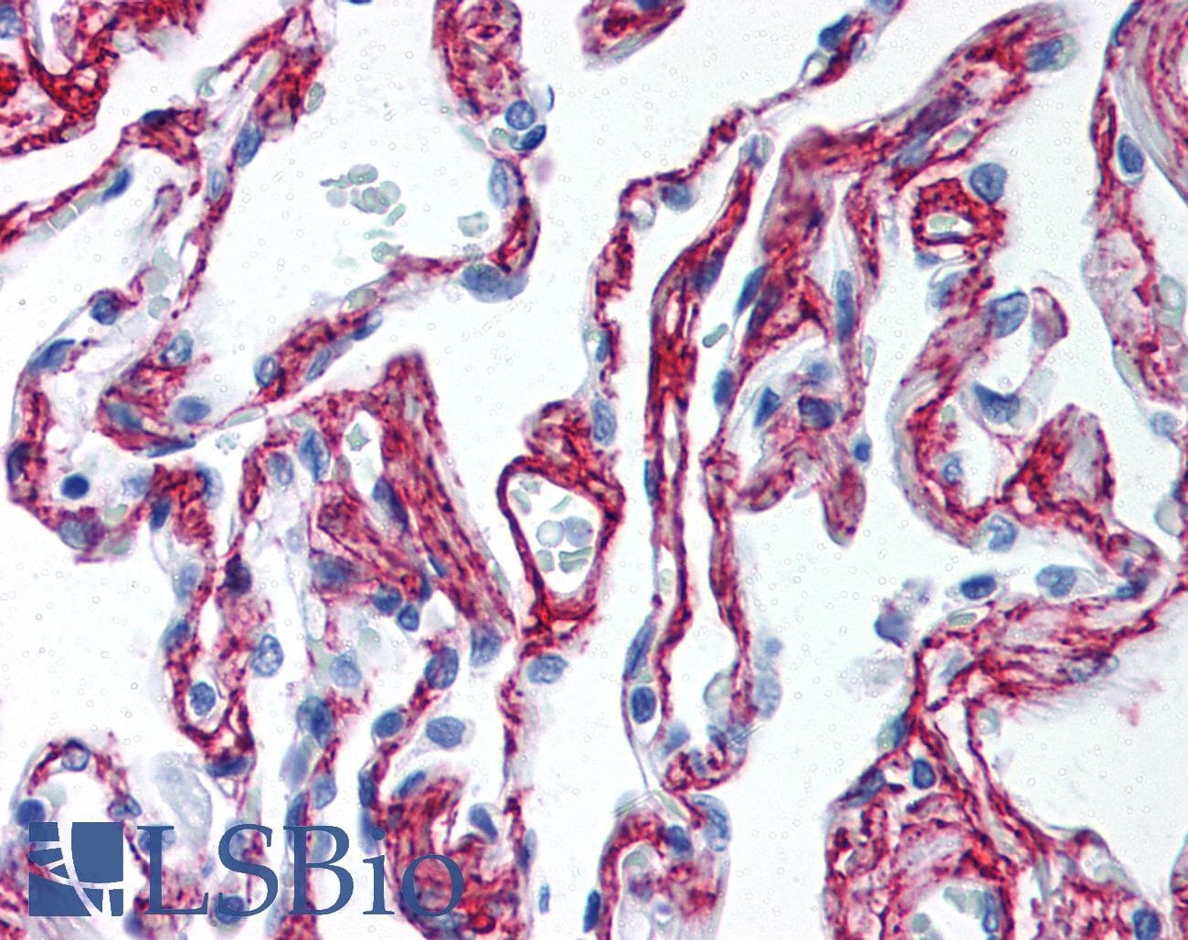 IHC-plus™ Polyclonal Rabbit anti-Mammal Collagen VI Antibody (IHC, WB)