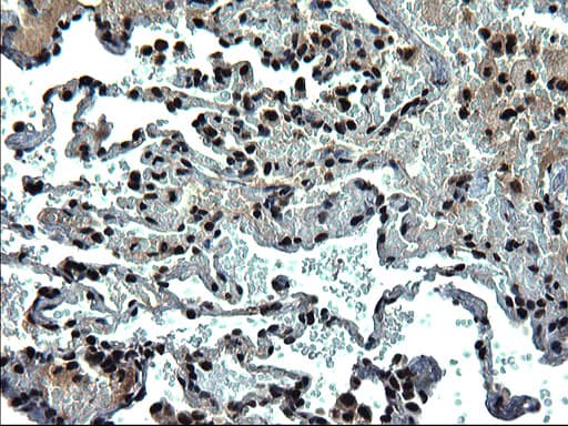RPRD1B Antibody (clone OTI1C9)