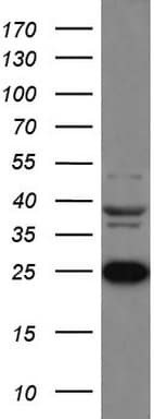 LGALS3 / Galectin 3 Antibody (clone UMAB157, Carrier-free)