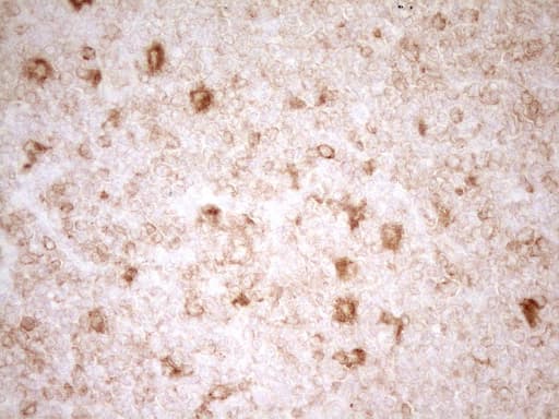 GRN / Granulin Antibody (aa327-593, clone OTI2F4)