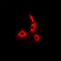 DCD / Dermcidin Antibody