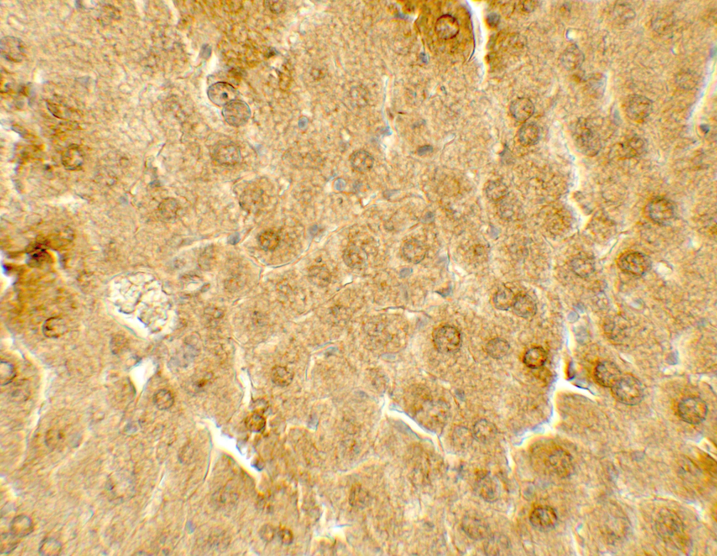 Polyclonal Rabbit anti-Human ME1 / Malate Dehydrogenase Antibody (IHC, WB)