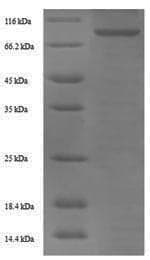Human F2 / Prothrombin / Thrombin Protein (Recombinant 6His-SUMO, N-terminus)