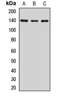 JARID2 / JMJ Antibody