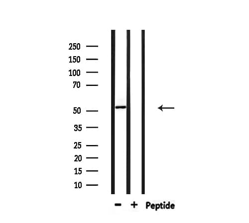 PFKFB1 Antibody