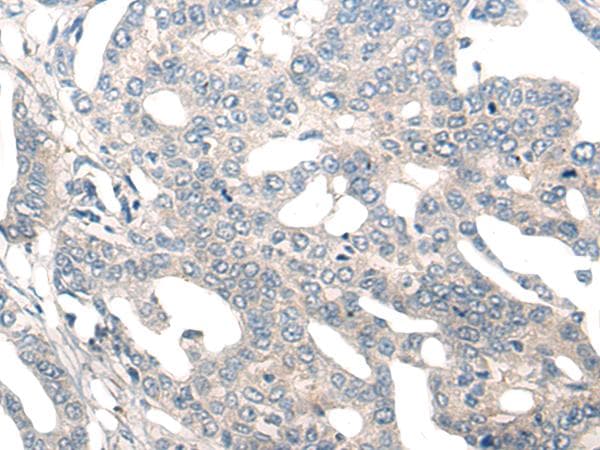 NOG / Noggin Antibody