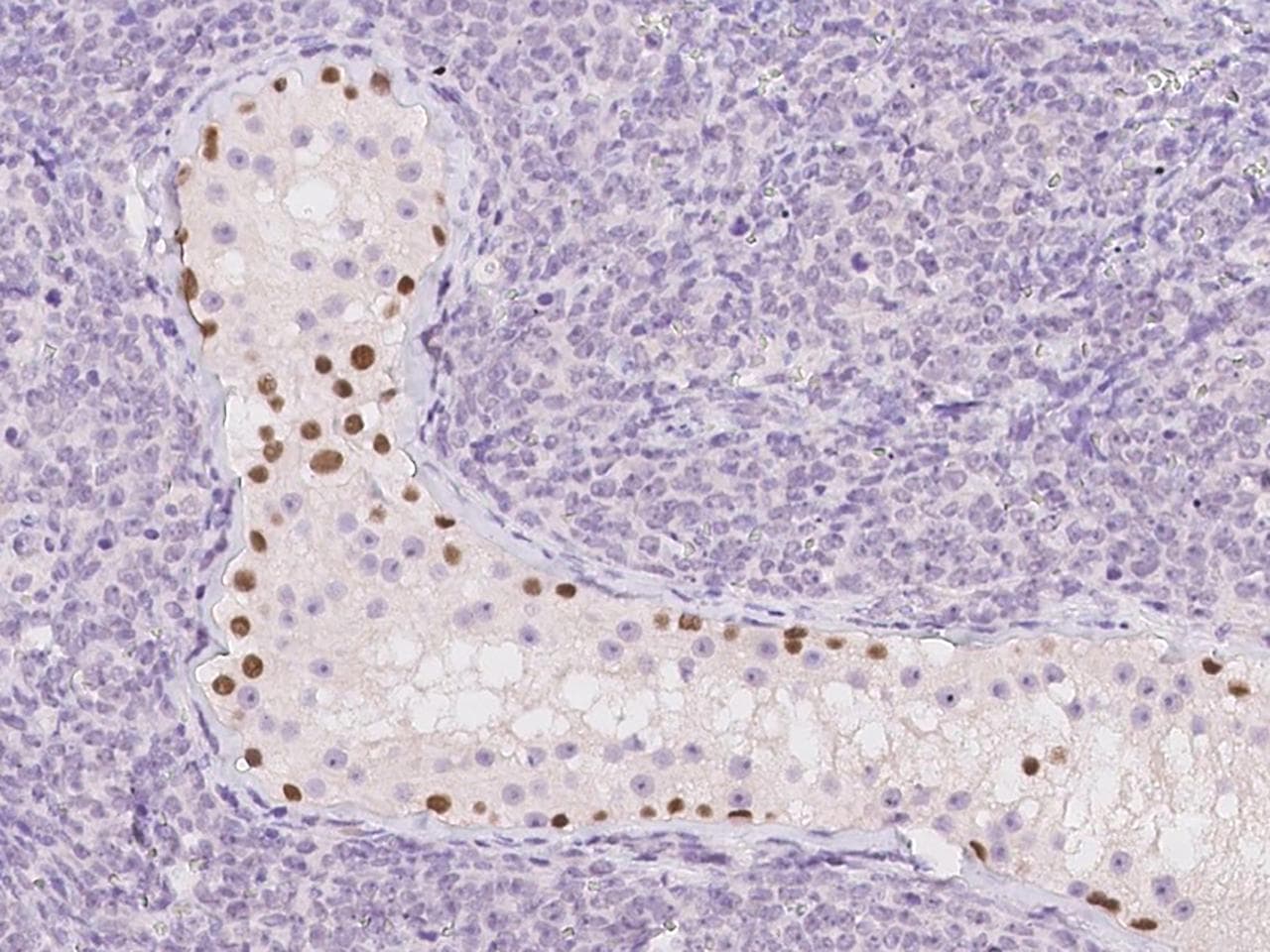 TGIF2LX Antibody