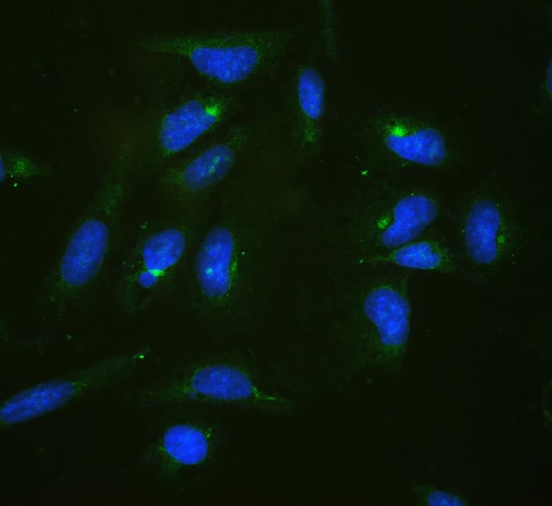 Polyclonal Rabbit anti-Human RPL19 / Ribosomal Protein L19 Antibody (WB)