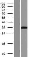 VSTM2B Protein (Over-Expression Lysate Myc-DDK (Flag))