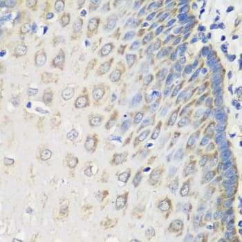 Polyclonal Rabbit anti-Human MSRB2 / MSRB Antibody (IHC, WB)