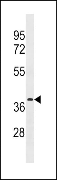 Polyclonal Rabbit anti-Human ER Alpha / Estrogen Receptor Antibody (aa271-300, IF, WB)