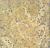 CYP2A7 Antibody (aa121-148)