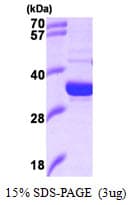 Human HMOX2 / Heme Oxygenase 2 Protein (Recombinant)
