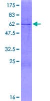 Human AGMAT Protein (Recombinant GST)