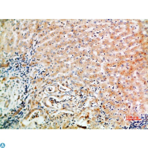 WISP3 Antibody