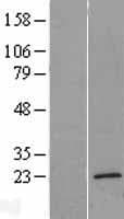 TMEM35 Protein (Over-Expression Lysate Myc-DDK (Flag))