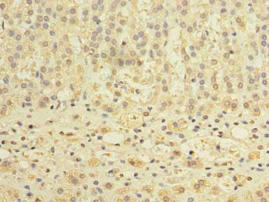 TCTE1 Antibody