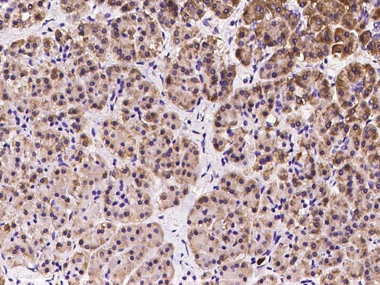 Polyclonal Rabbit anti-Human OS9 Antibody (IHC)