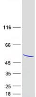 Human HMG20A Protein (Recombinant Myc-DDK (Flag))
