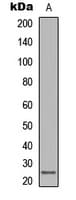 Lymphotoxin-Beta / LTB Antibody (C-Terminus)