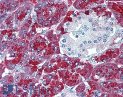 IHC-plus™ Polyclonal Rabbit anti-Human CPA1 / Carboxypeptidase A Antibody (Internal, IHC, WB)