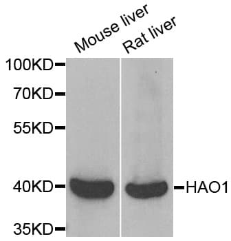 IHC-plus™ HAO1 Antibody