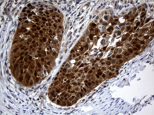 CSE1L Antibody (aa1-300, clone OTI4G1)