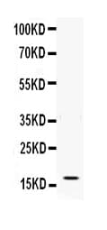Polyclonal Rabbit anti-Human IFN Gamma / Interferon Gamma Antibody (aa24-166, IHC, WB)