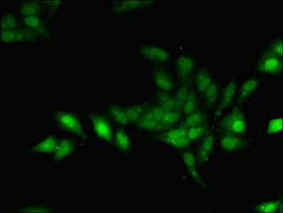Polyclonal Rabbit anti-Human Geminin Antibody (IHC)