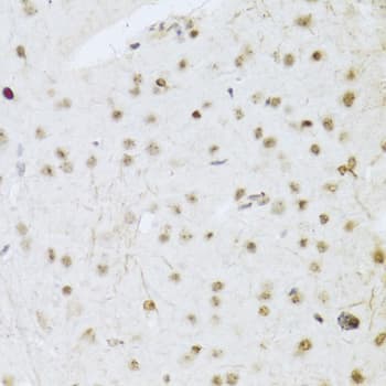 Polyclonal Rabbit anti-Human MAPK3 / ERK1 Antibody (IHC, IF, WB)