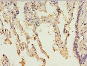 HsT19268 / MTHFS Antibody (aa2-203)