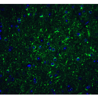 PathPlus™ BECN1 / Beclin-1 Antibody